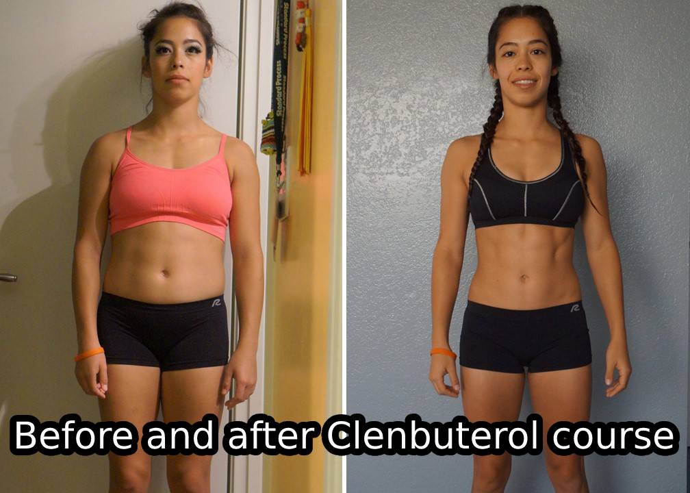 Before and after Clenbuterol course